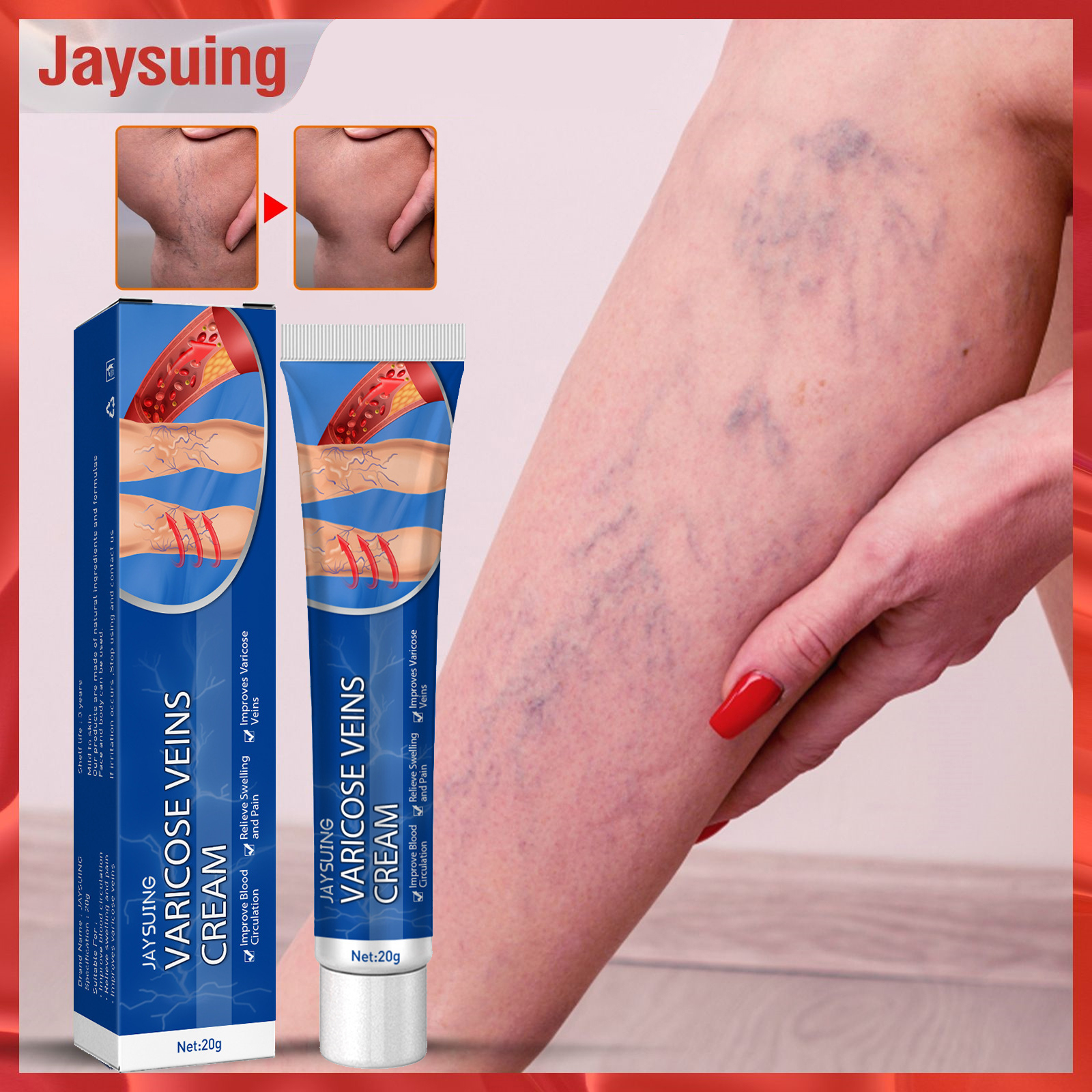 Jaysuing Varicose Veins Treatment Cream Relieve Tired Legs Pain Removal