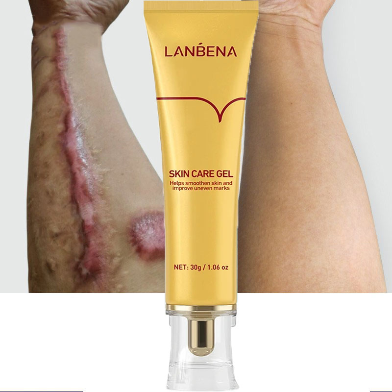 New Packaging LANBENA TCM Scar Ance Mark Removal Skin Repair Cream