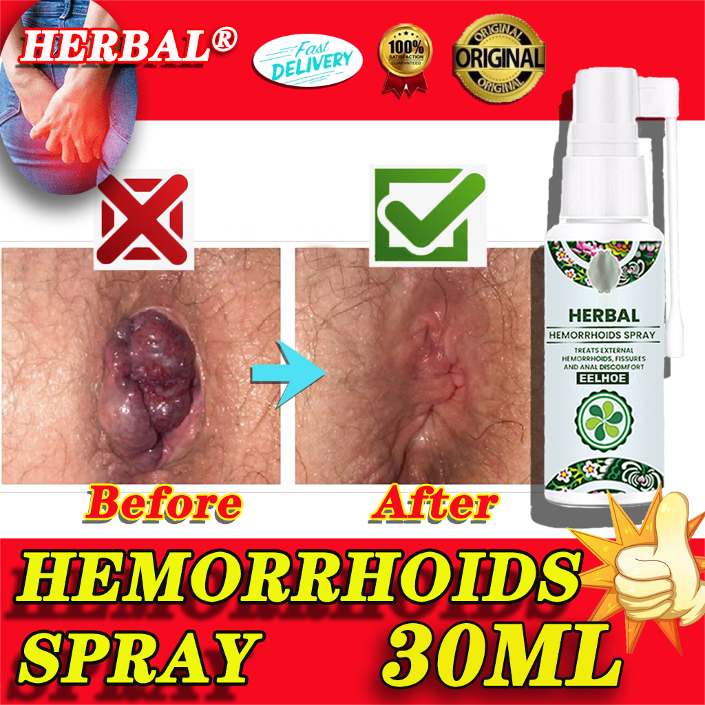 Herbal Hemmoriodcomfortable Ointment Hemorrhoids Miracle Ointment