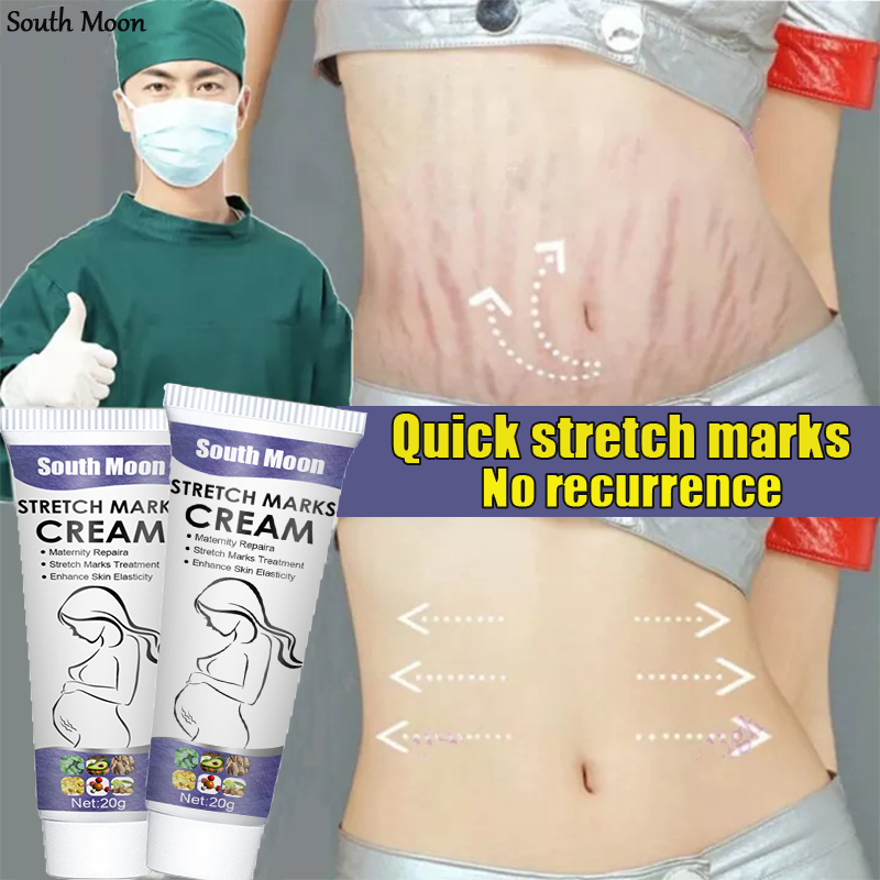 Stretchmark Remover Cream Anti Stretch Mark Cream Effectively Remove