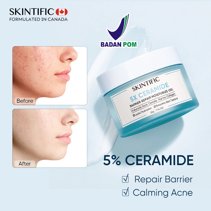 Skintific Moisturizer 5x Ceramide Moisture Gel Skintific Lazada Indonesia