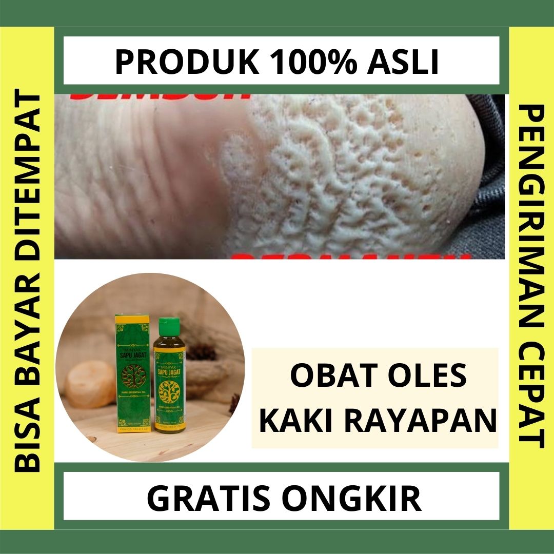 Obat Kaki Rayapan Minyak Oles Jamur Kaki Gatal Sela Jari Tinea