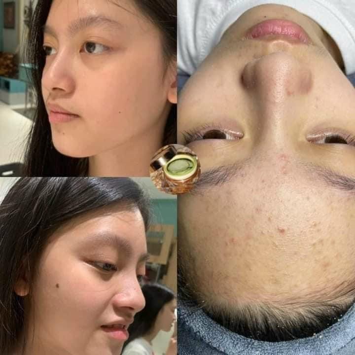 Kem trà xanh thảo dược