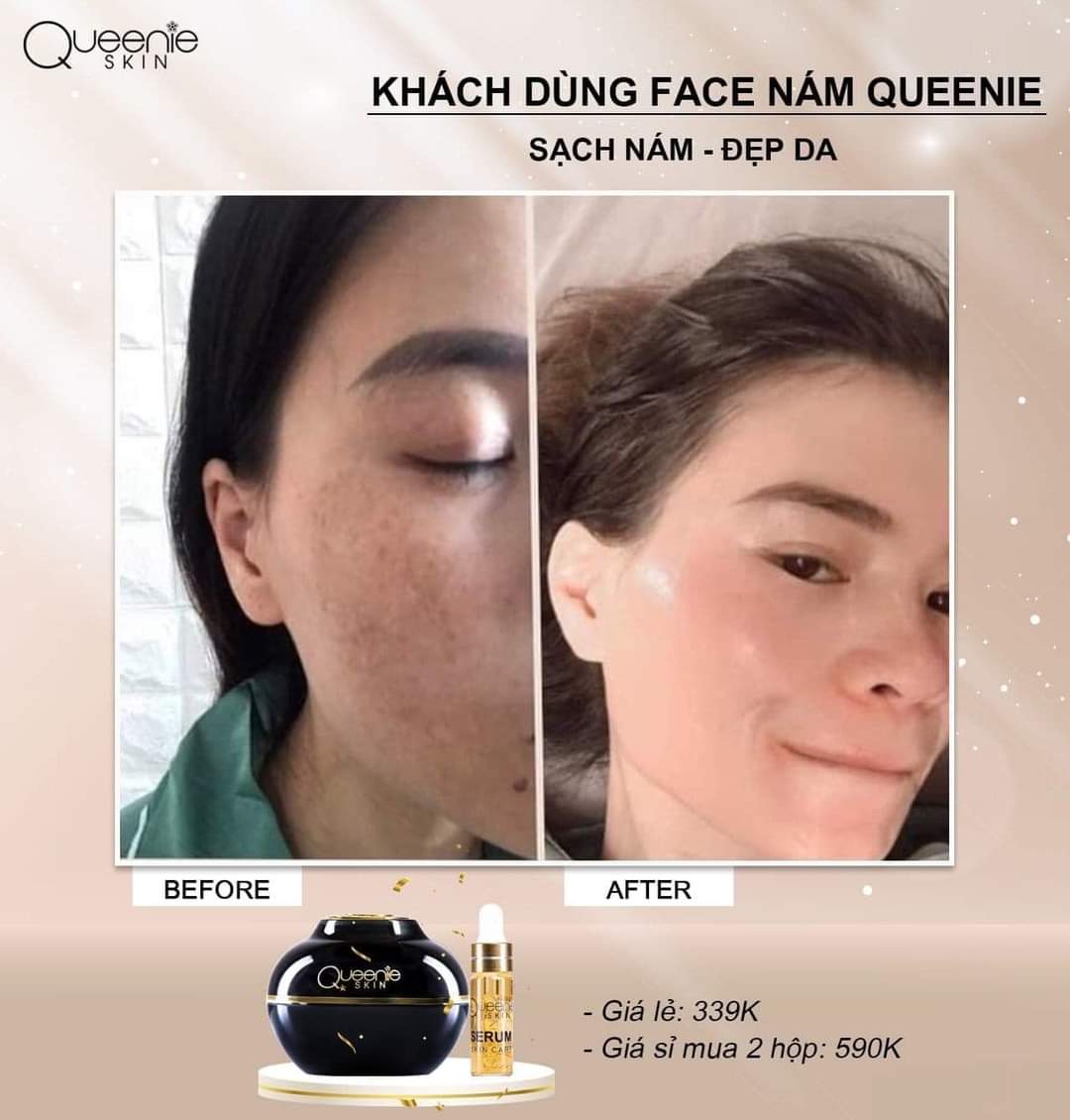 Kem làm mờ nám, tàn nhang