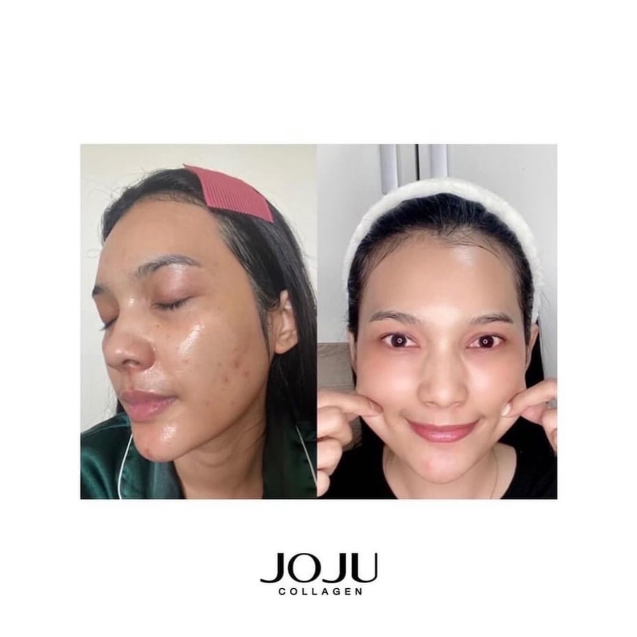 [Order] COLLAGEN JOJU THÁI LAN mẫu mới