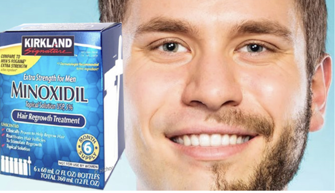 Minoxidil