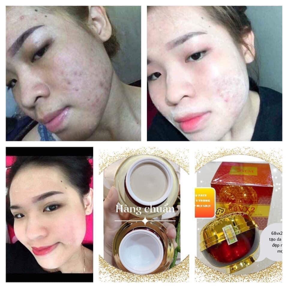 Kem tái tạo cao cấp 68vx2