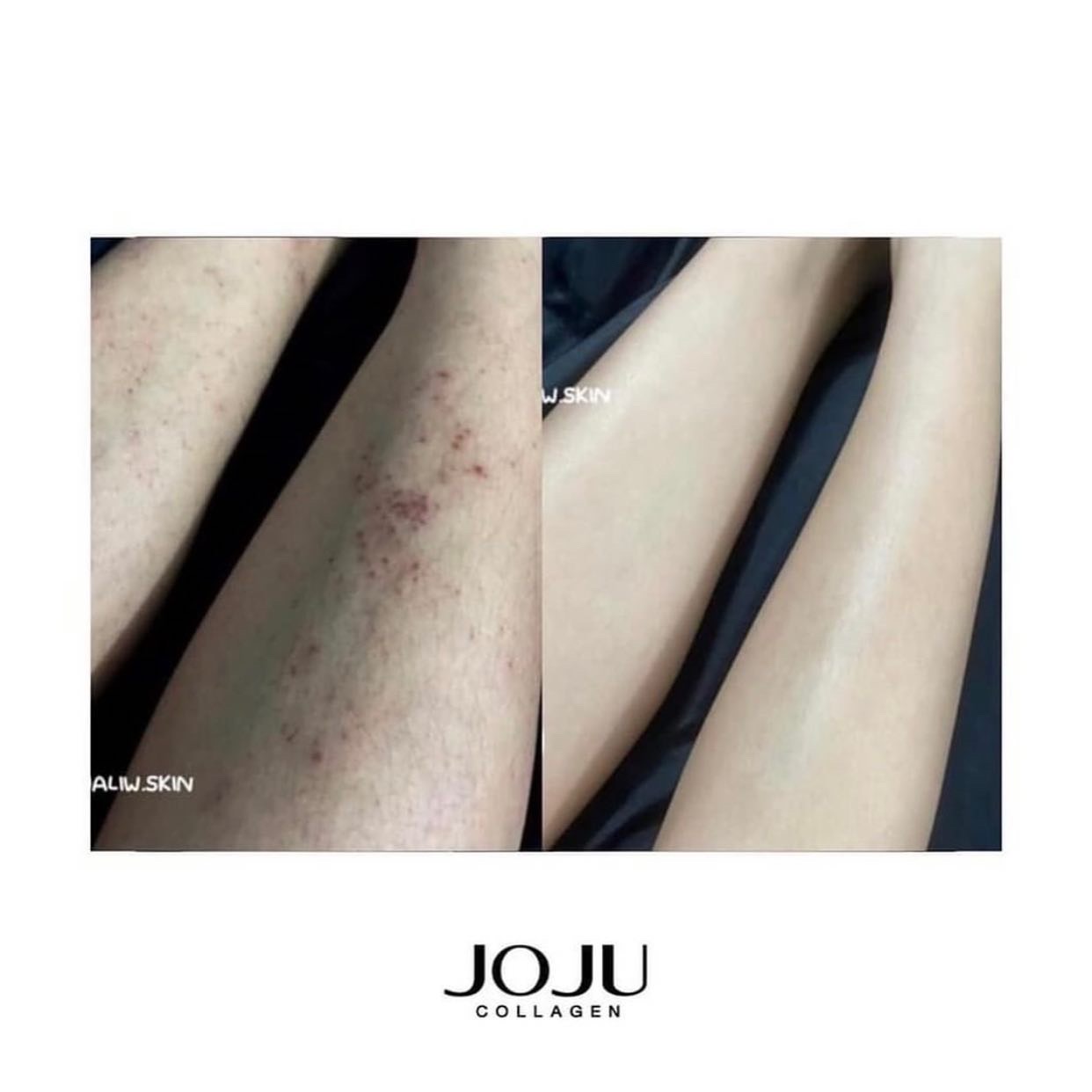 [Order] COLLAGEN JOJU THÁI LAN mẫu mới