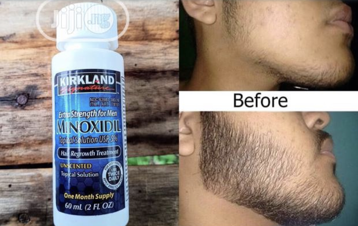 Minoxidil