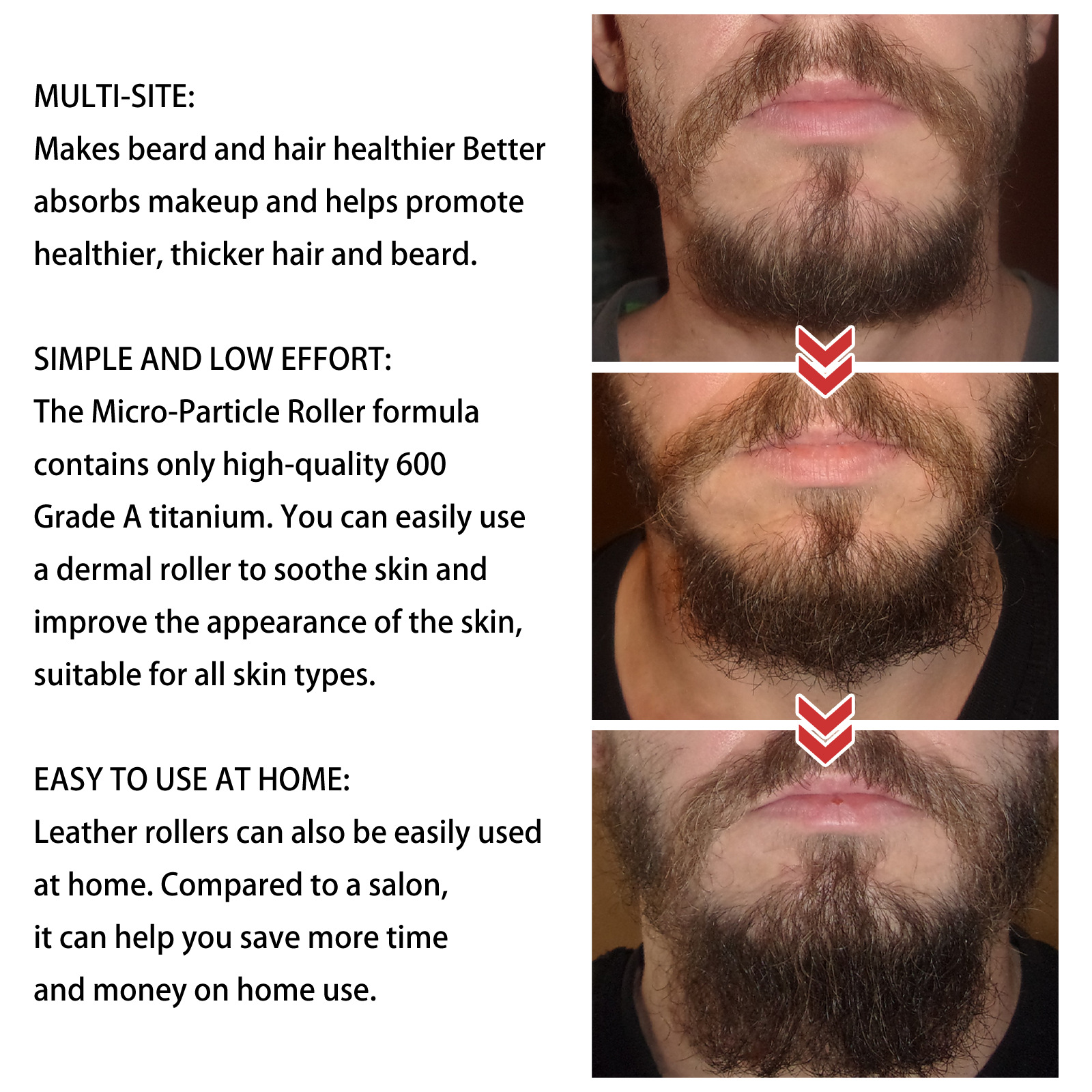 West Month Con Lăn Derma Con Lăn Mọc Râu Cho Nam Con Lăn Vi Kim Con Lăn Phục Hồi Râu Mọc Lại Râu & Tóc Chăm Sóc Mọc Râu (30G)