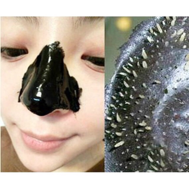 Gel Lột Mụn Đầu Đen Handmade