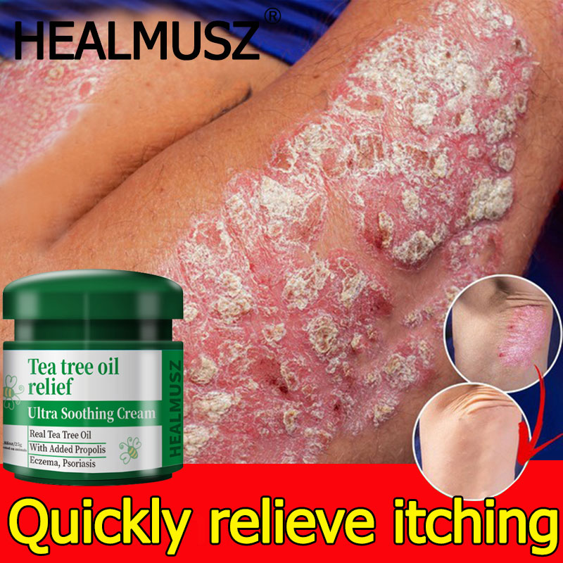HEALMUSZ Herbs Cream Specializing In Various Itchy Skin Problems Herbal