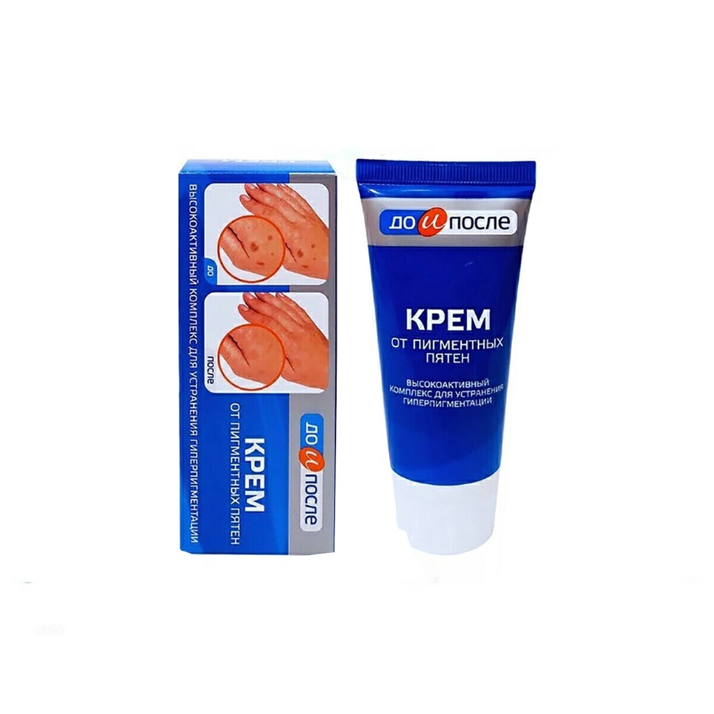 Kem đồi mồi kpem nga bôi đồi mồi, nám, sạm, đốm nâu da tay, lão hoá da tay
