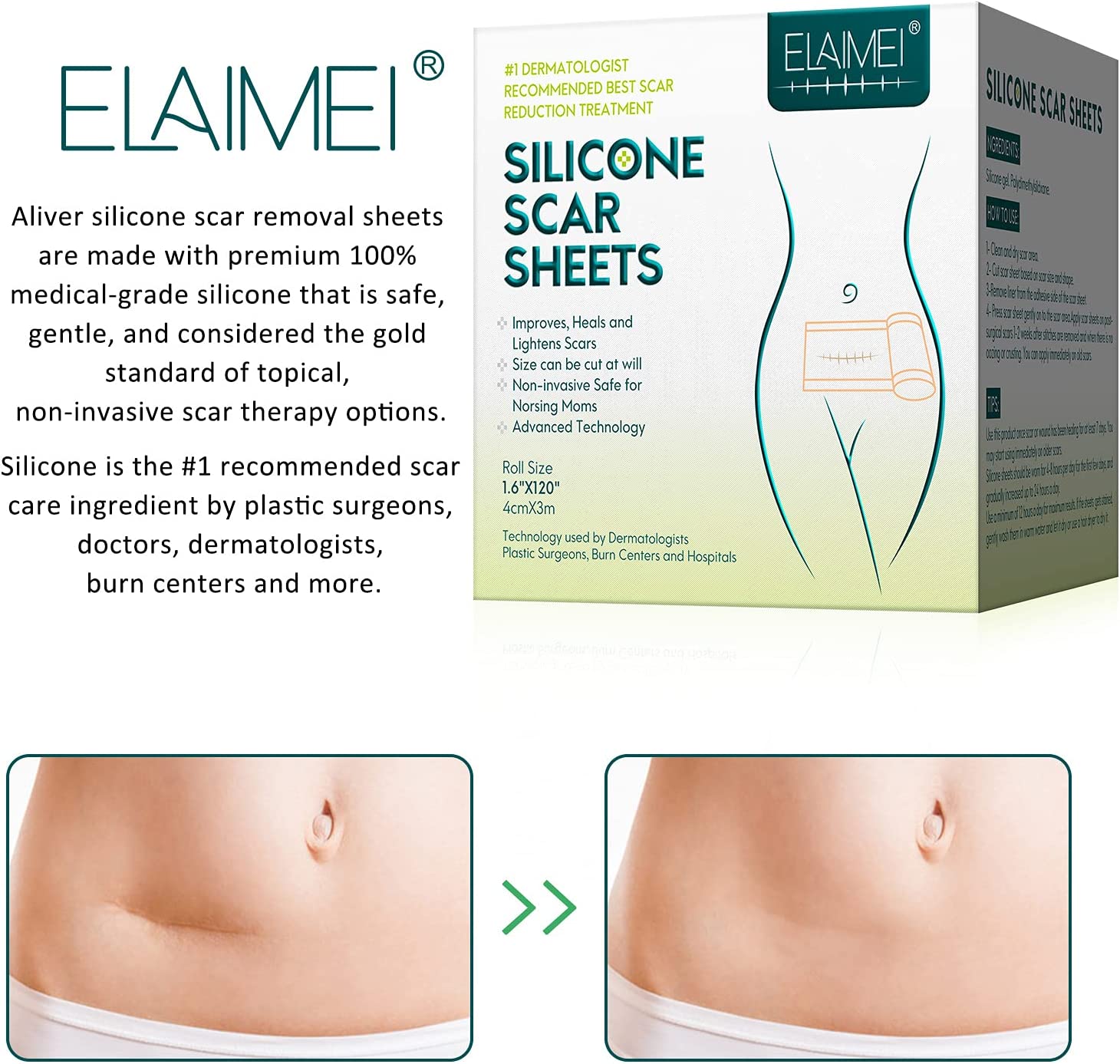 New model 1.5M/3M Scar Removal Patch Surgery Self-Adhesive Silicone Gel Tape Remove Scar Patch Sticker Acne Trauma Burn Scar Skin Care. 