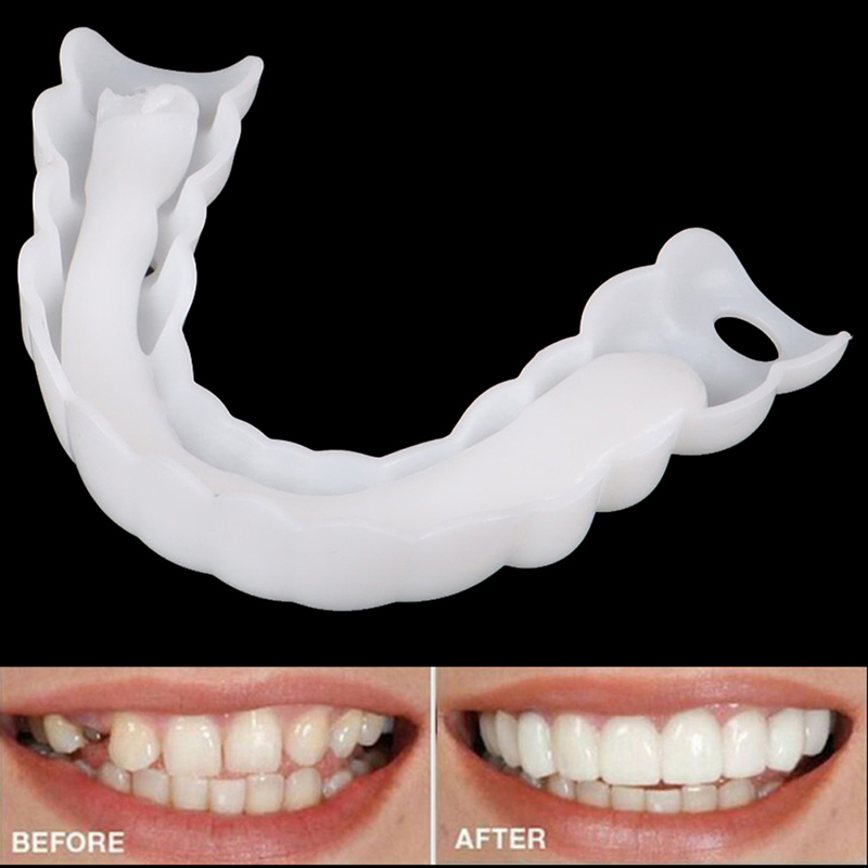 Orthodontic%20Beauty%20Teeth%20Corrector%20Inferior%20Braces%20Tooth%20Retainer%20Tools%20Cleaning%20tools%20GHAN%20-%20Image%203