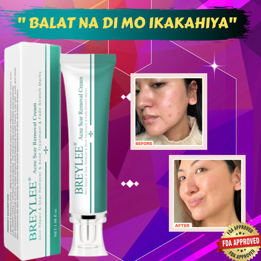 Original BREYLEE Acne Scar Removal Cream Face Cream Skin Repair Skin