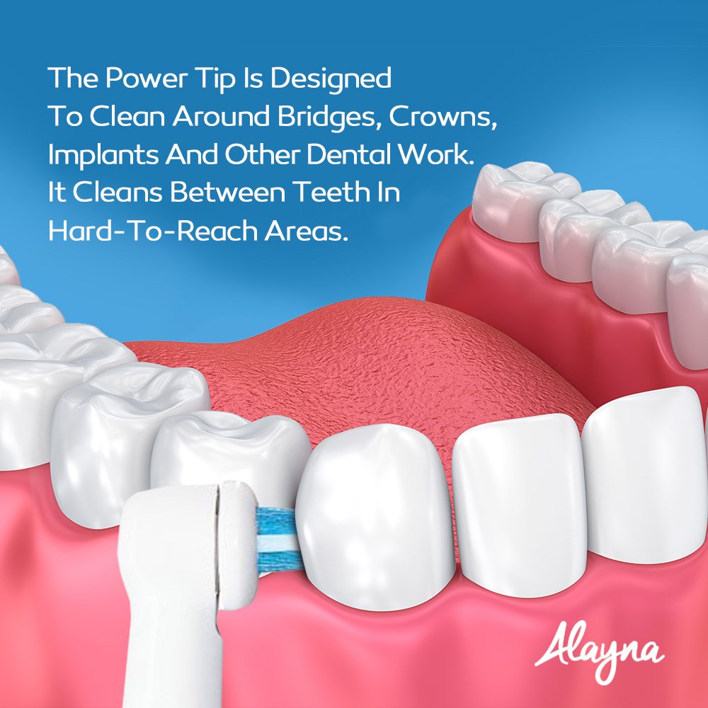 %E3%80%90EleganceWorld%E3%80%91Oral%20B%20Interproximal%20Clean%20Replacement%20Brush%20Heads%20For%20Oral-B%20Professional%20Ortho%20Orthodontic%20Electric%20Toothbrush%20Heads%20-%20Image%204