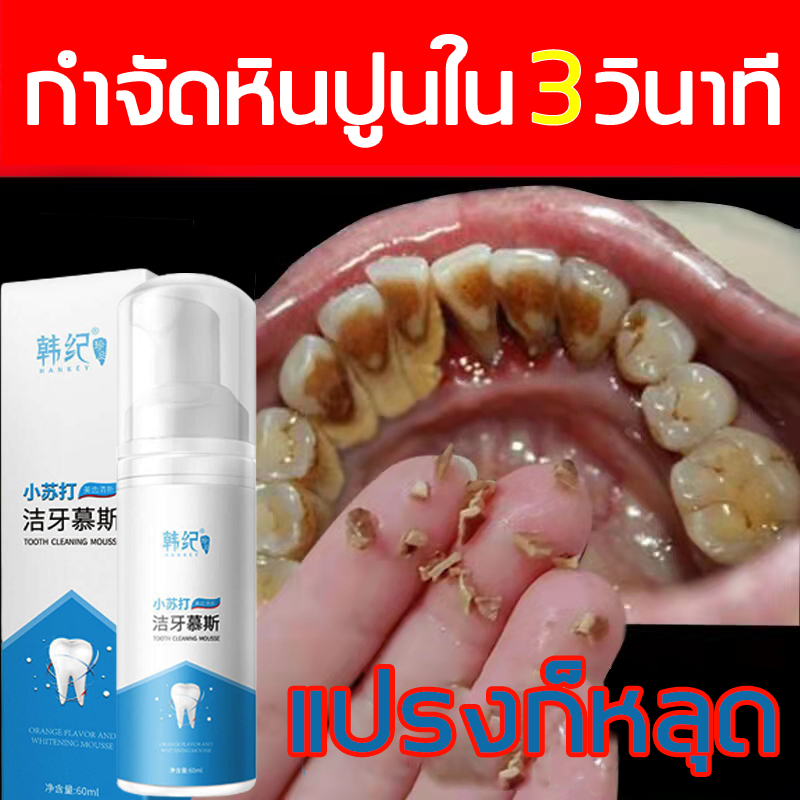 ยาสีฟันฟันขาว 7-11