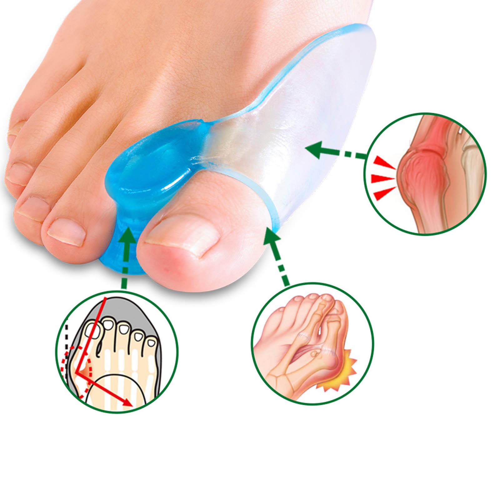 Baosity BaosityBig Toe Bunion Guard, Bunion Pad Spacer Protector Toe Separator, for Overlapping Toes