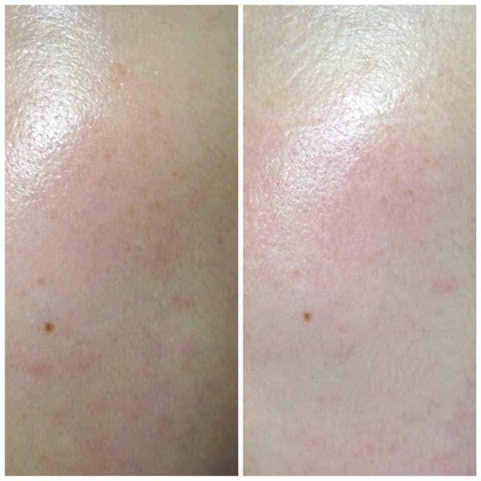 Nước Hoa Hồng căng bóng da Dr. Pepti+ Centella Toner