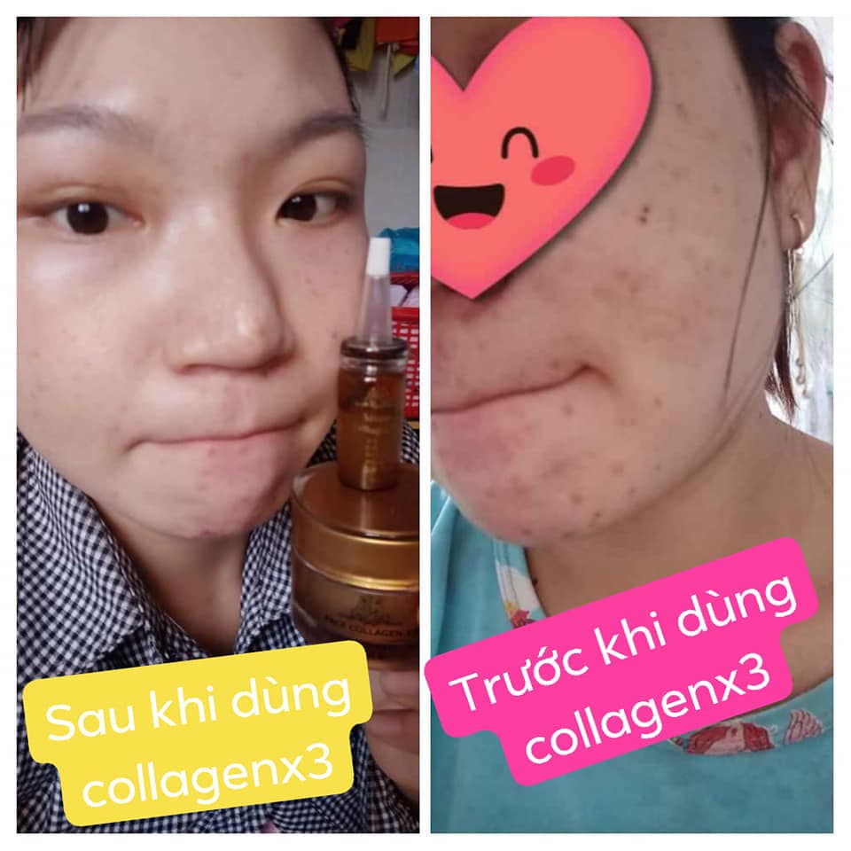 Combo Mỹ Phẩm Đông Anh chính hãng (Kem Face Collagen X3 + Kem Chống Nắng Colagen X3)