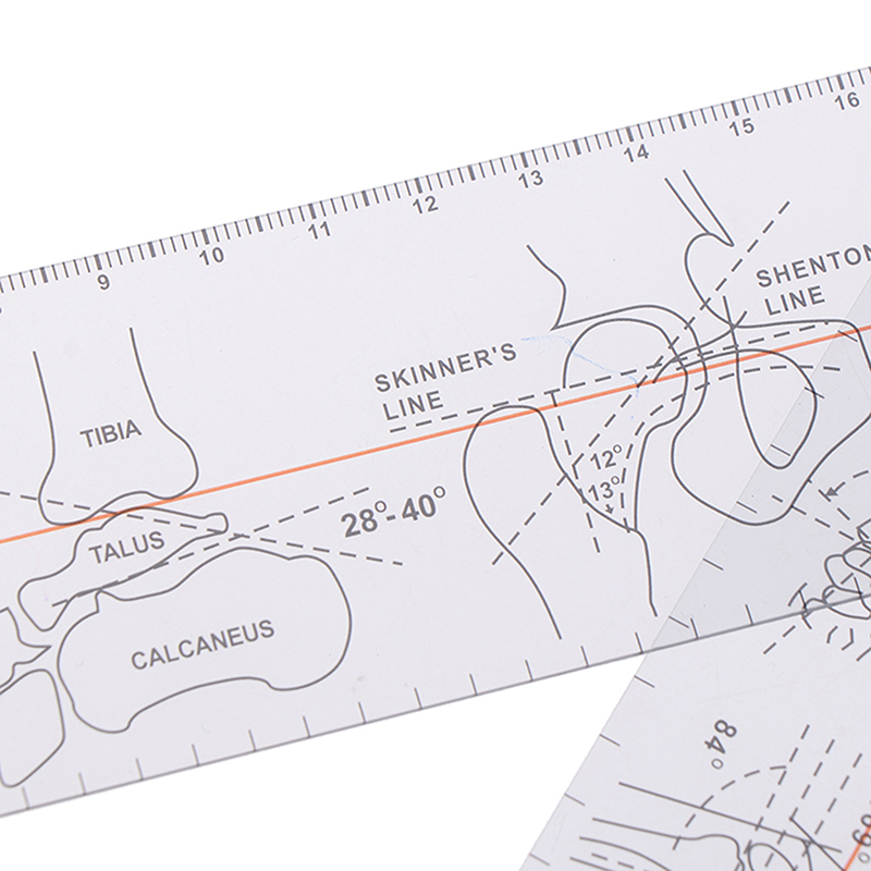 Long Jointing Ruler Multi-Ruler Goniometer Angle Ruler Joint Orthopedics Tool Instruments ...
