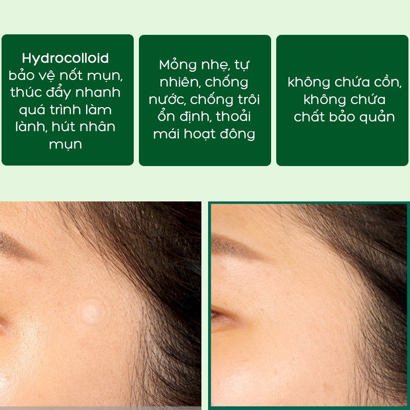 Miếng Dán Mụn "Thần Kỳ' Some By Mi Clear Spot Patch
