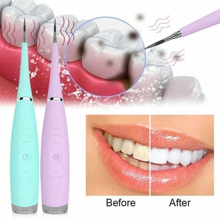 Dụng cụ lấy cao răng - máy lấy cao răng tại nhà cao cấp