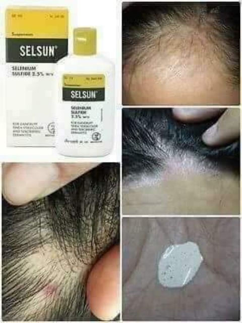 DẦU GỘI GẦU SELSUN THÁI LAN CHAI 120ml