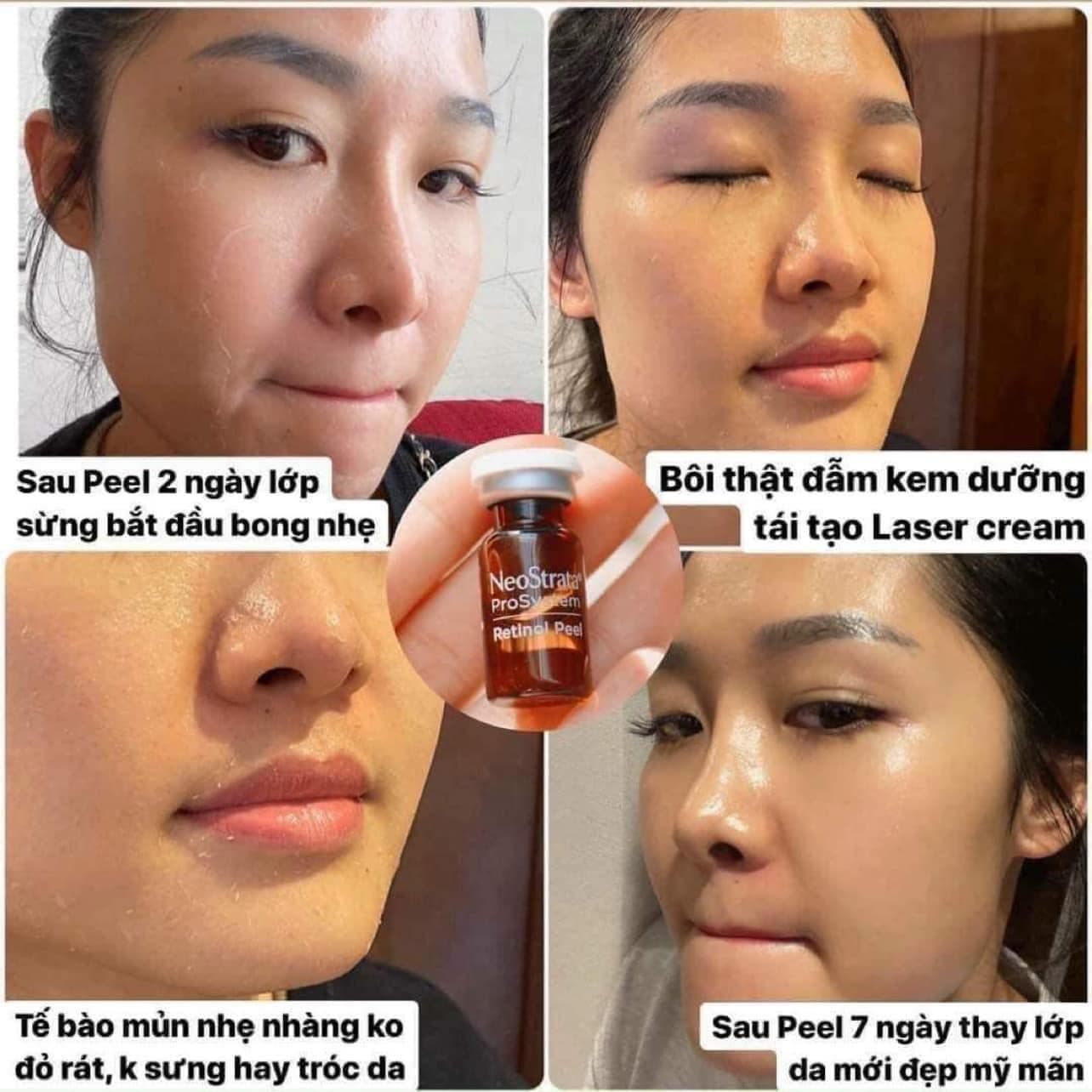 Thay da sinh học Neostrata peel