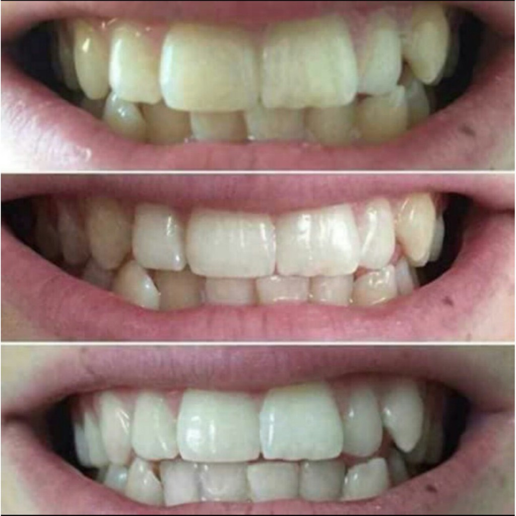 Kem Đánh Răng Ap24 Nuskin Whitening Fluoride Toothpaste 110g
