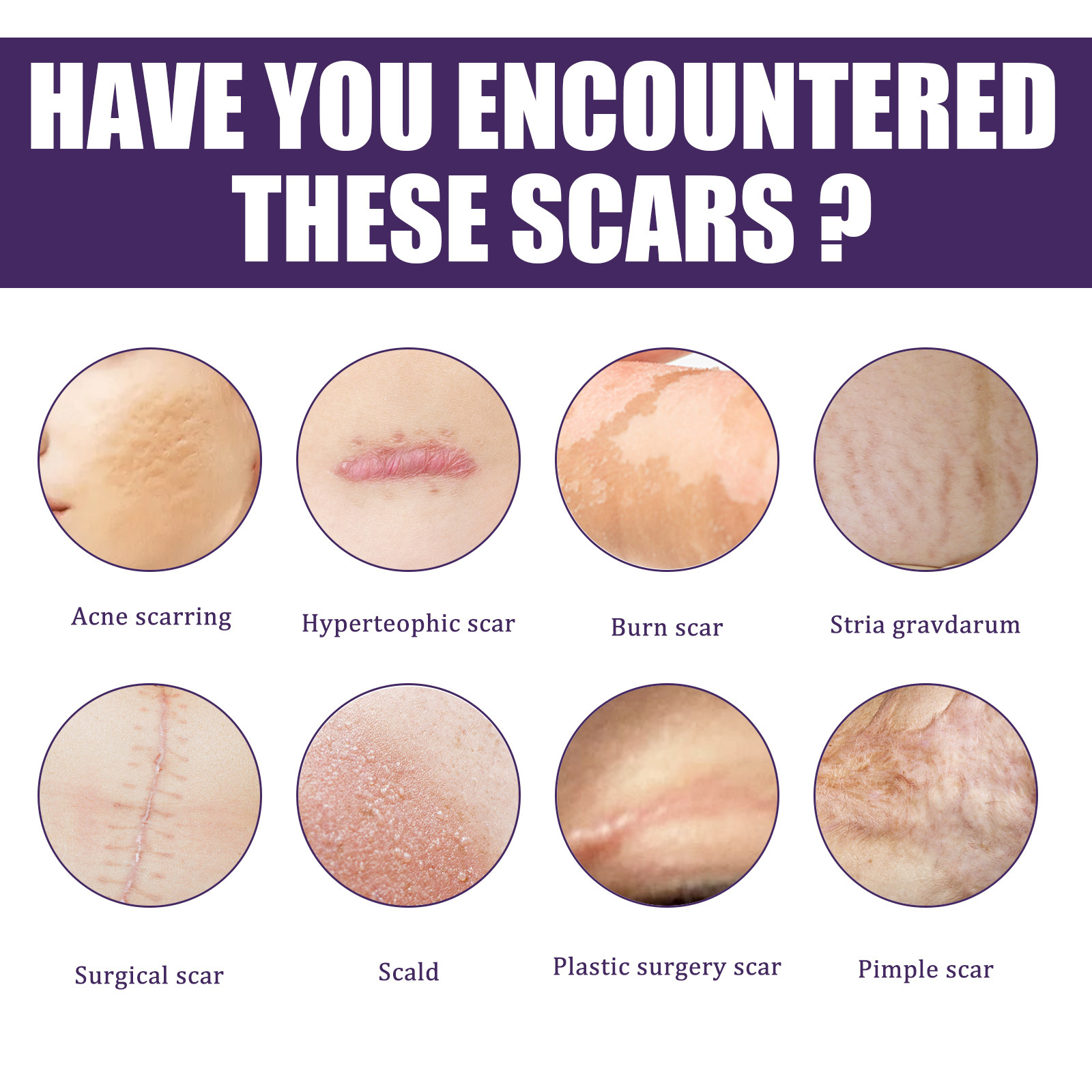 Scar%20Treatment%20Silicone%20Gel%20Sheet%20Eliminate%20Stretch%20Mark%20Scald%20Burn%20Scar%20Removal%20Acne%20Trauma%20Skin%20Repair%20Fade%20Surgery%20Scar%20Patch%20-%20Image%2010