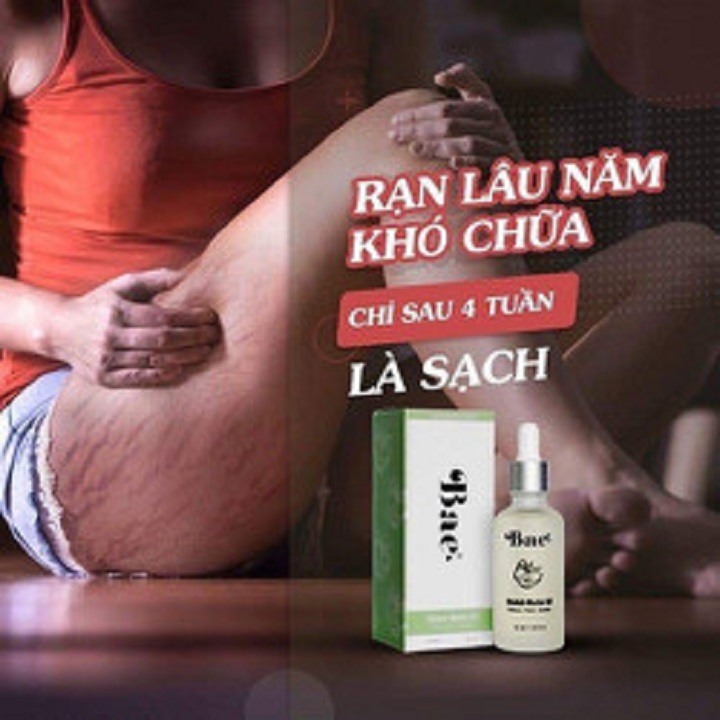 CHAI TINH DẦU RẠN DA BAE HÀN QUỐC LOẠI 50ml/1 chai-