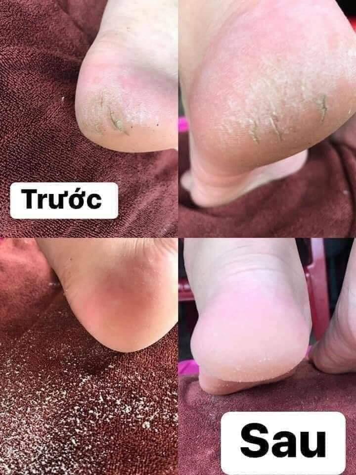 xe gà tập đi cho bé