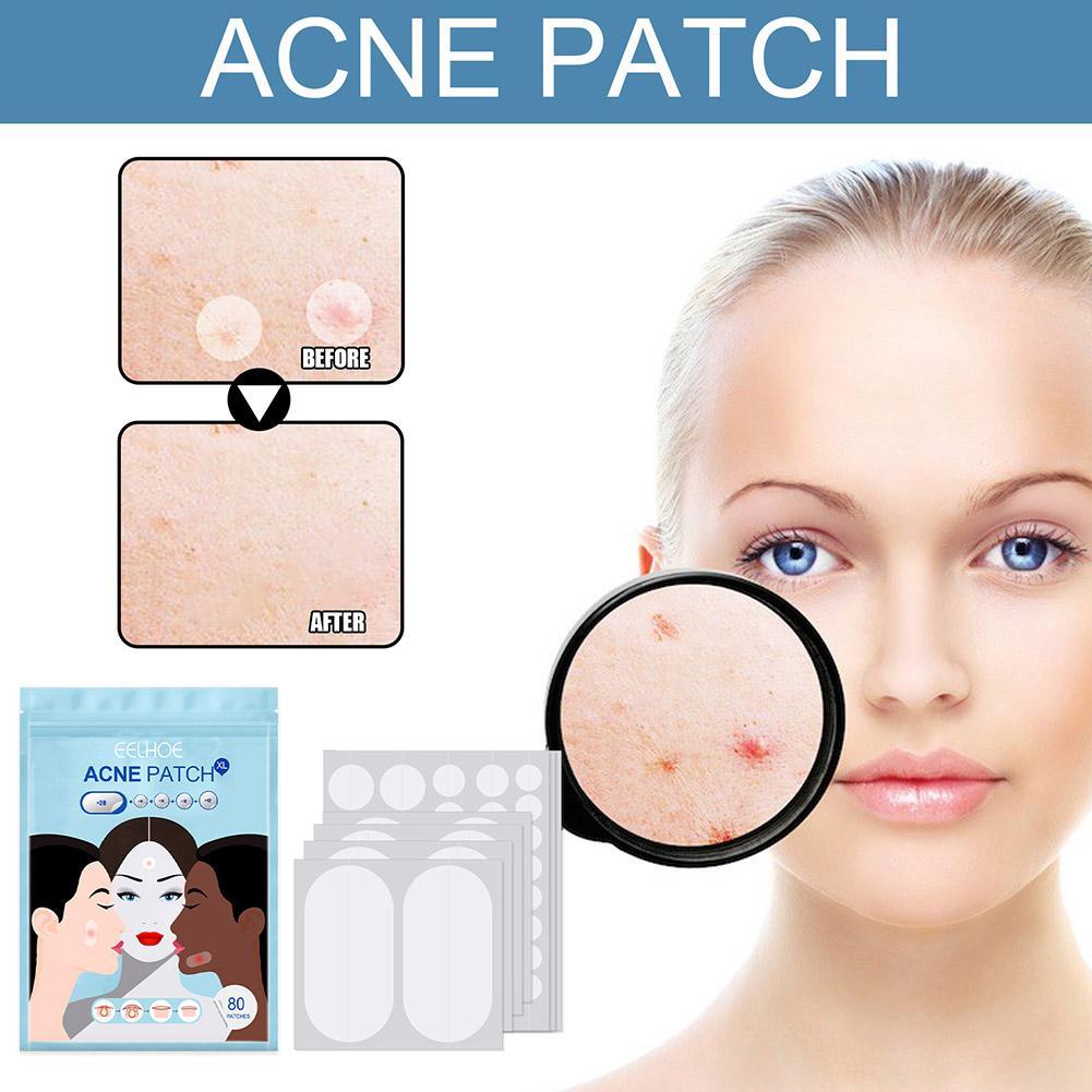 Yuanyan%2080pcs/set%20Large%20Size%20Acne%20Pimple%20Patch%20Face%20Treatment%20Invisible%20Tools%20Acne%20Remover%20Blemish%20Pimples%20Stickers%20D3T7%20-%20Image%203
