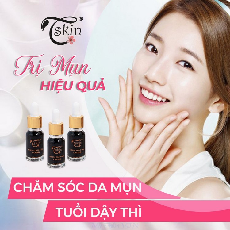 Serum dưỡng trắng da mờ thâm mụn căn bóng da Caviar 10ml