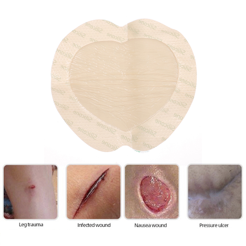 1pc%20Silicone%20Wound%20Patch%20Bedsore%20Dressing%20Patch%20for%20Pressure%20Ulcer%20Junna%20-%20Image%209