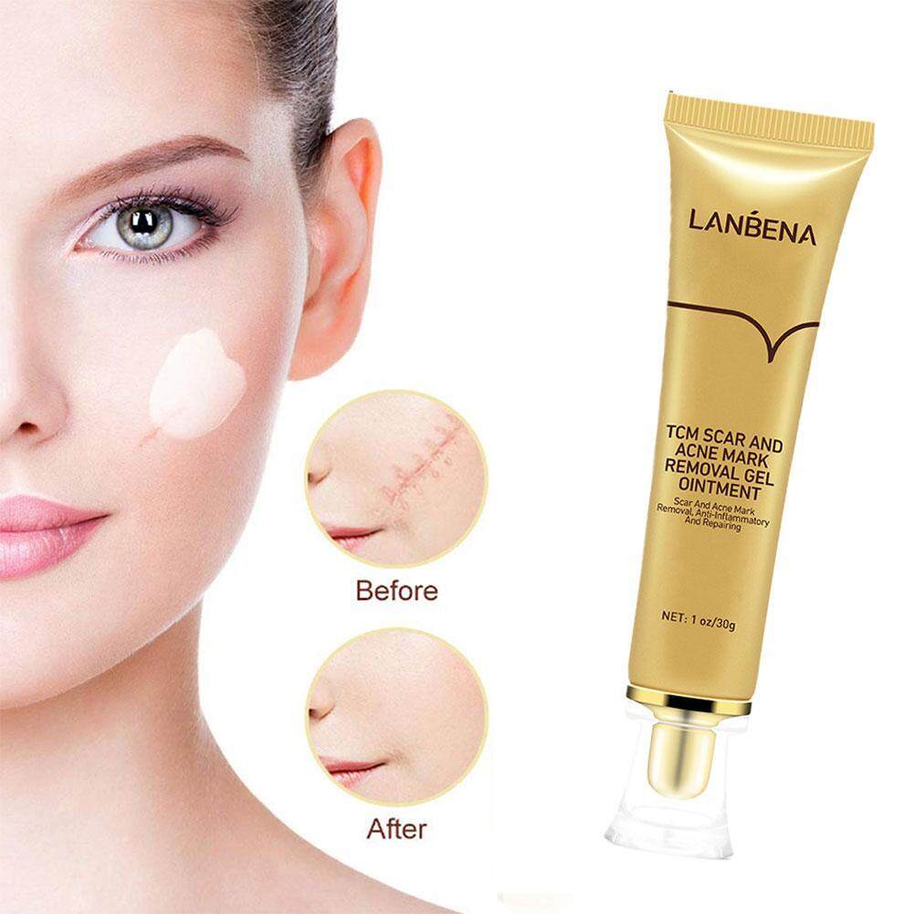 Lanbena%20TCM%20Scar%20And%20Acne%20Mark%20Removal%20Gel%20Ointment%2030G%20-%20Image%202