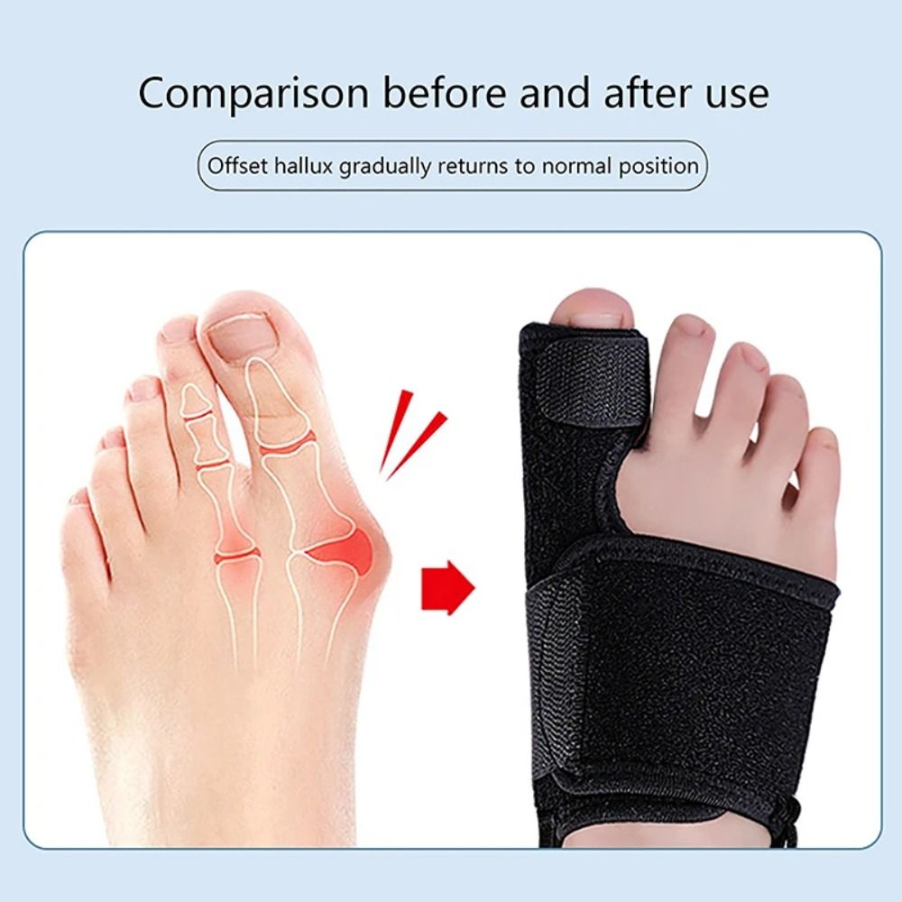 INSUFFICIENCY68IN9 Hammer Protector Big Toe Bunion Protector Bone Thumb Adjuster Orthotics Bunion Corrector Durable Pedicure Sock Toe Corrector Foot Care