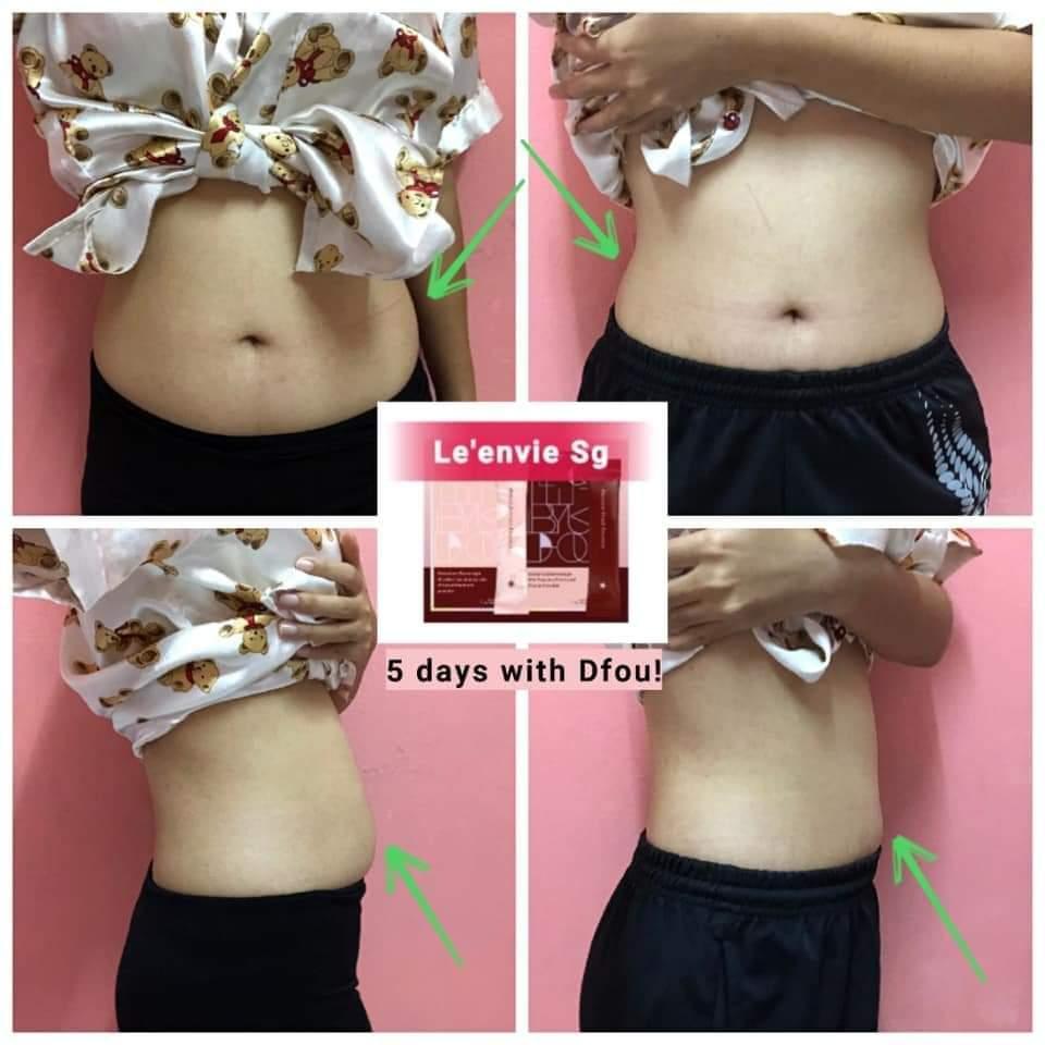 Dfou 2in1 Set For Slimming And Beauty Effect Detox Slimming Fat Reduction Stem Cell Beauty Block Carbo And Oil Block Sugar Absorption Lower Cholesterol Reduce Water Retention Improve Digestive System Skin