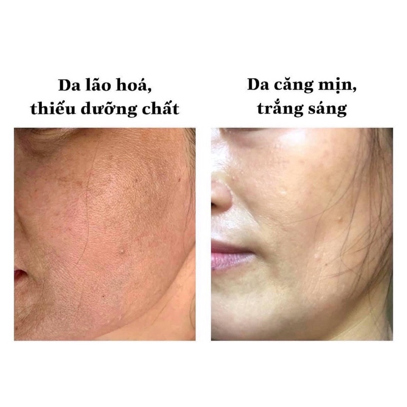 Kem Lightening Protection Cream (Kem Tailor Made K) 30g – Hỗ Trợ Làm Sáng Da, Mờ Thâm Nám