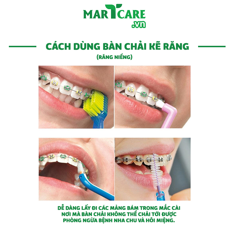[GÓI 6C] Bàn Chải Kẽ Răng Dạng Chữ L Chính Hãng OKAMURA Asahi Nhật Bản Cho Răng Niềng Chỉnh Nha