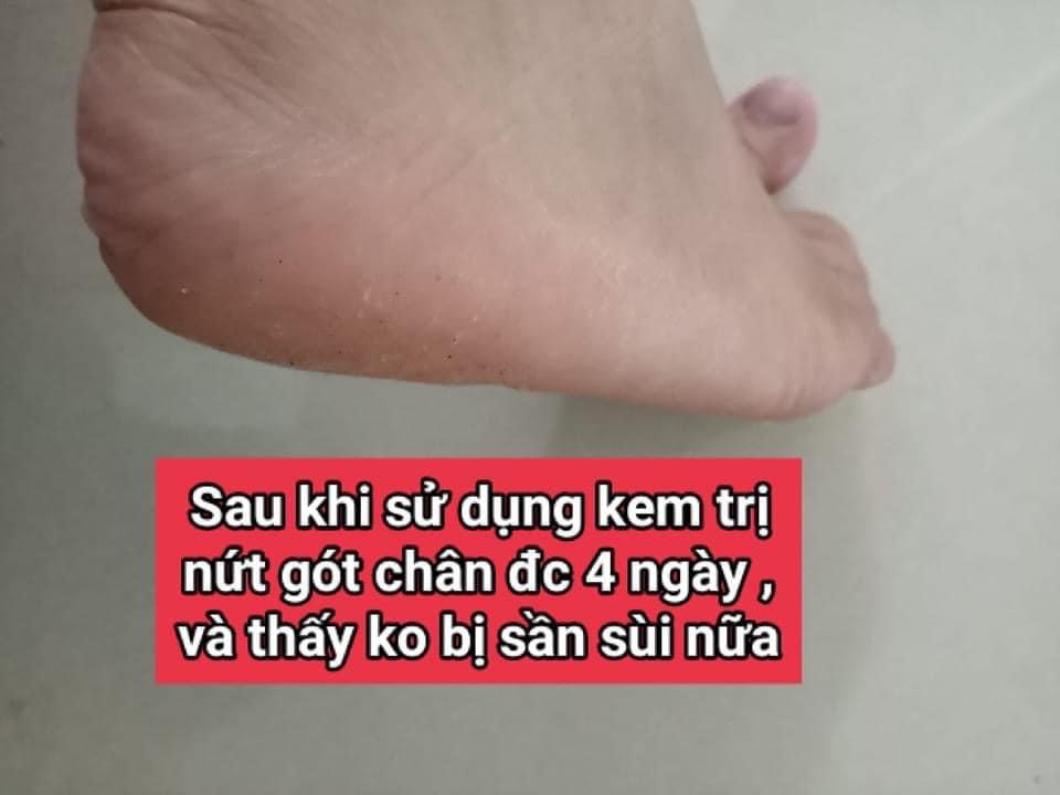 Kem Dưỡng Da Chân- EPOCH SOLE SOLUTION FOOT TREATMENT