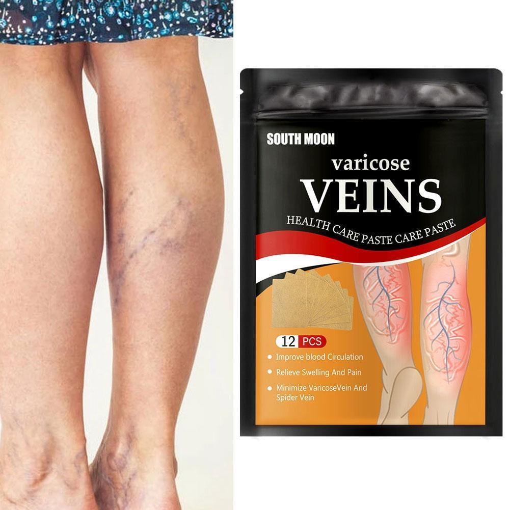 【GlowBound】12 PCS Varicose Veins Patches Dredge Vein Smoothing Varicose ...