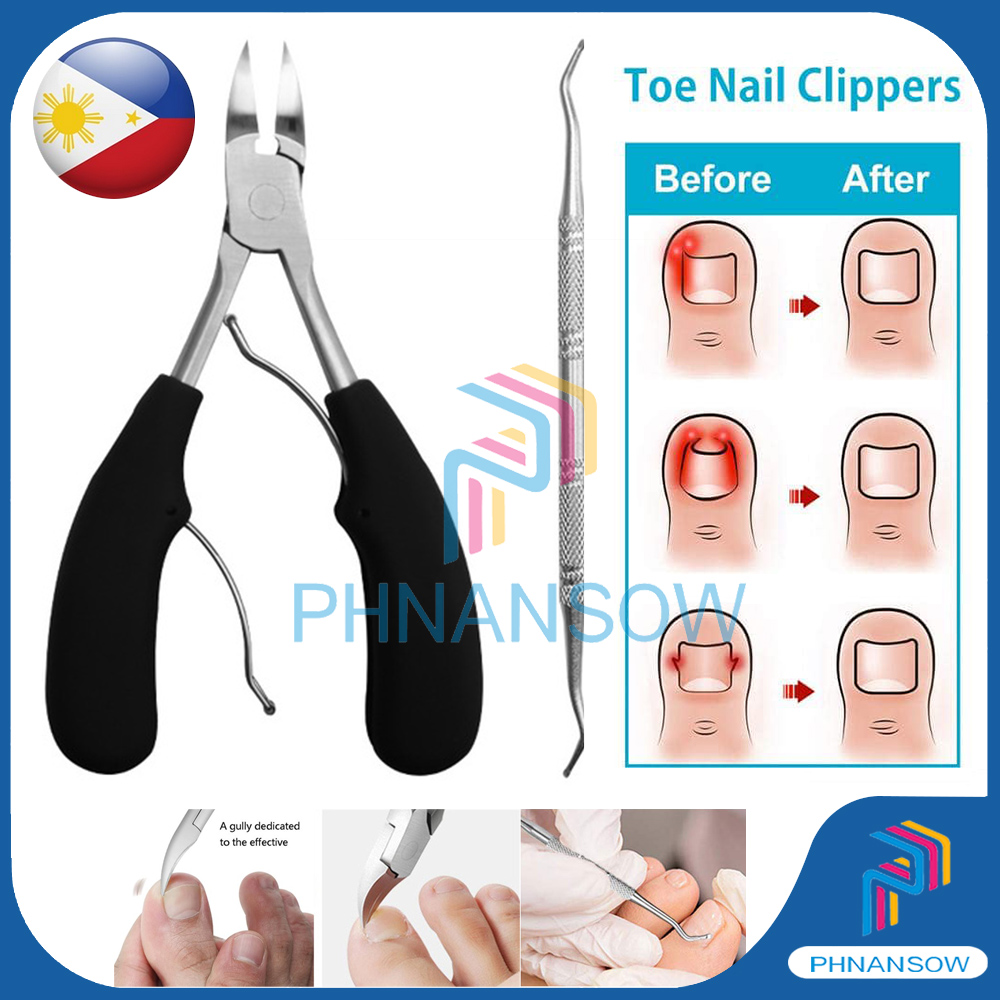 Toe Nail Clippers 2in1 Remove Dead Skin Nail Correction Nippers Ingrown