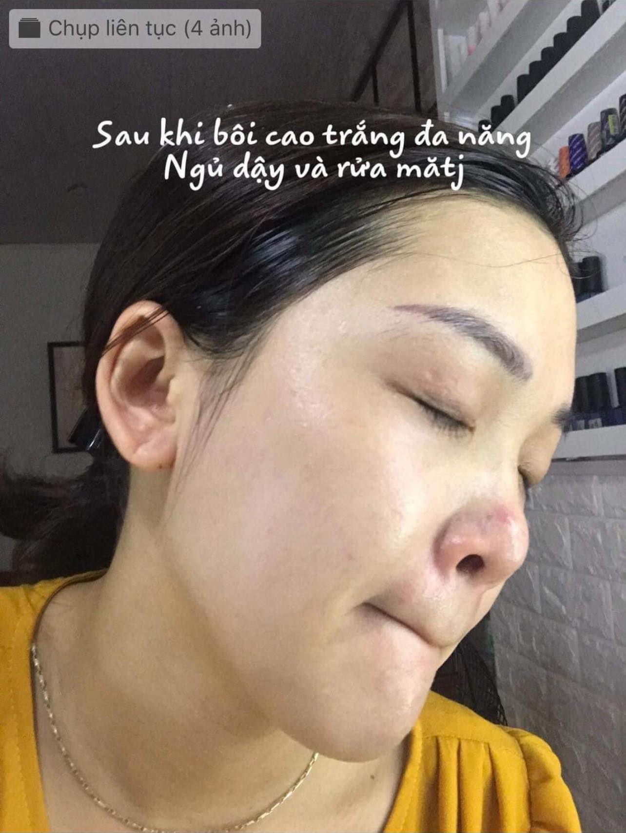 Cao Trắng Da Duyên Thị Bách Y Sâm Mẫu Mới 10Gr