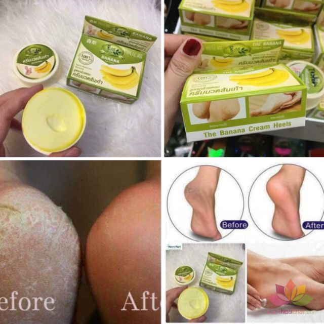 Kem Dưỡng Da Nứt Gót Chân Chuối Thái Lan 30ml