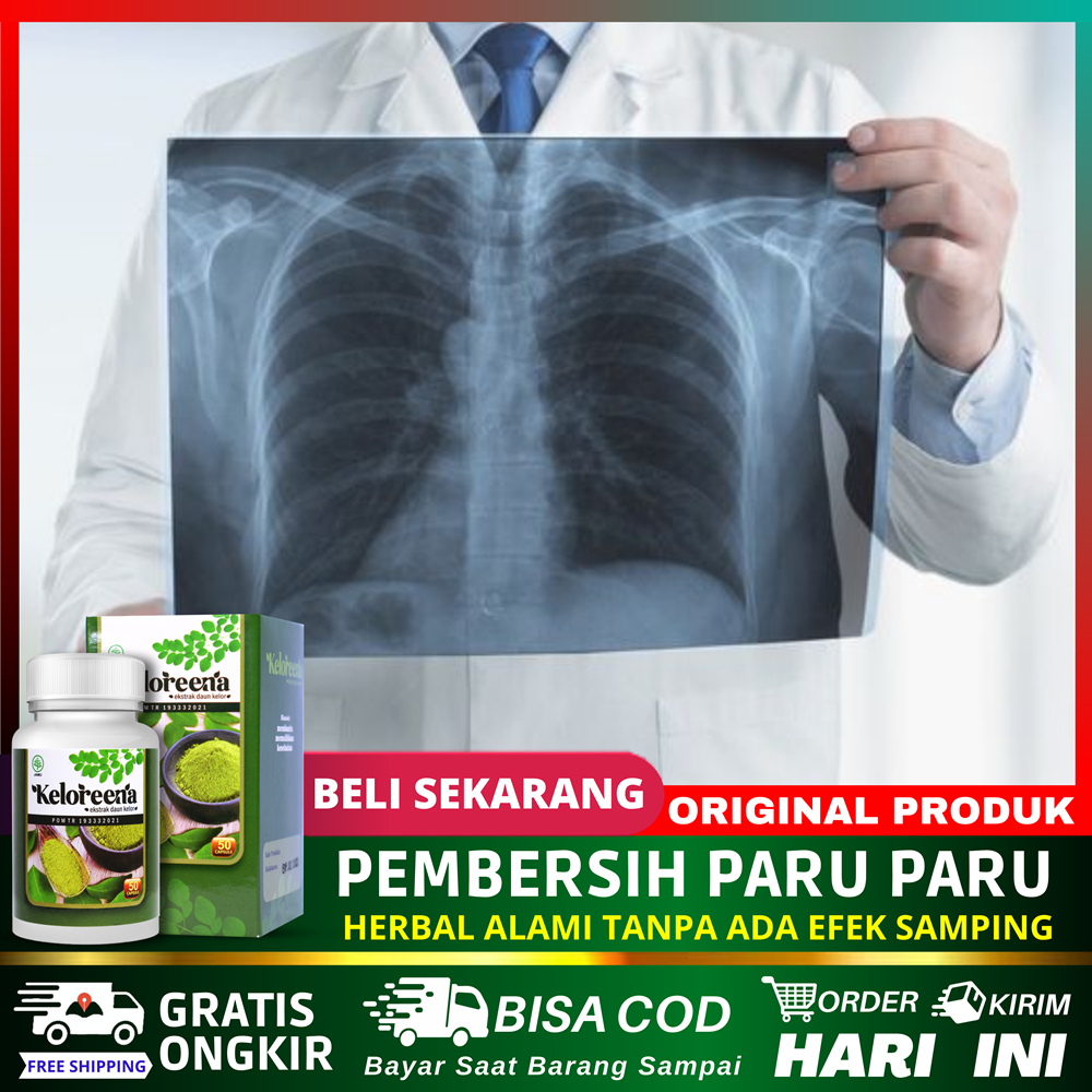 Obat Paru Paru Kronis Batuk Berdarah Paru Paru Kering Sesak Nafas Batuk Berdahak Pembersih Paru2 6785