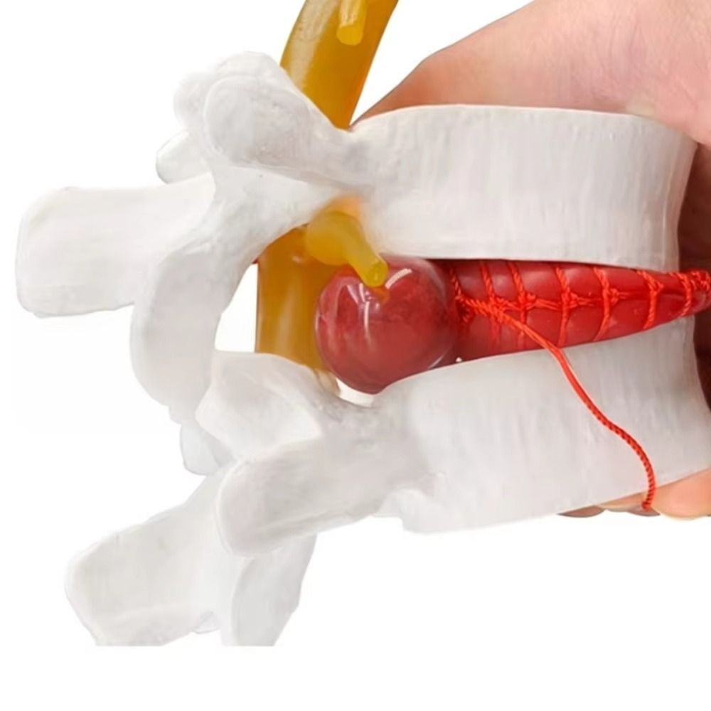 Use%203D%20Model%20Lumbar%20Model%20Compression%20Demonstration%20Spinal%20Pressure%20Lesions%20Human%20Anatomy%20Skeleton%20Model%20Educational%20Tool%20Simulation%20Spine%20Demonstration%20Structure%20Student%20-%20Image%202