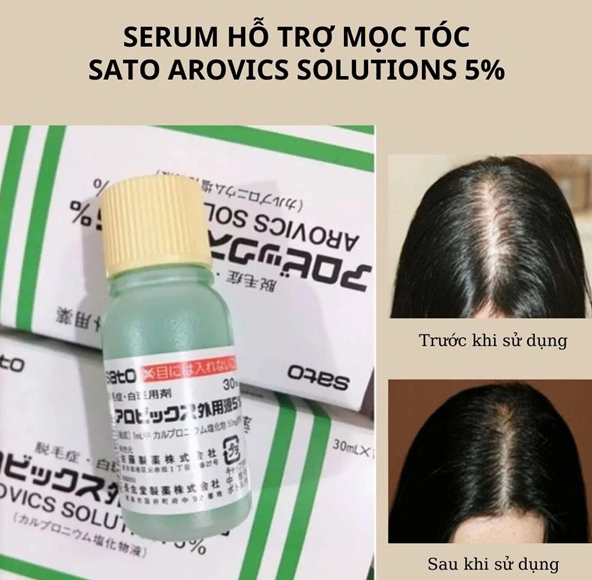 TINH CHẤT MỌC TÓC SATO NHẬT BẢN 30ML - Tách Lẻ (1 Lọ)
